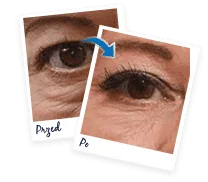 Nivelage eye cream